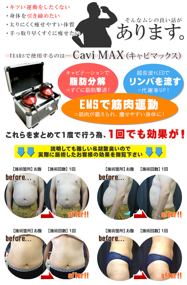 痩身 ベルファム CaviMAX（キャビマックス）｜TEARS～大阪府堺市
